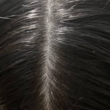 scalp after 3 months of supplements