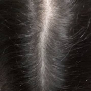 scalp before 1 month of supplements